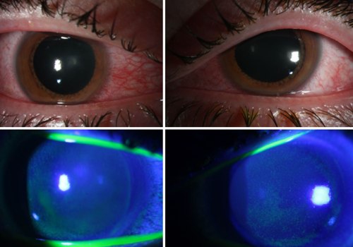 The Truth About UV Light and Its Smell